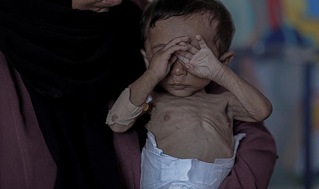 Gazze'de 2'si çocuk 4 kişi daha açlıktan hayatını kaybetti